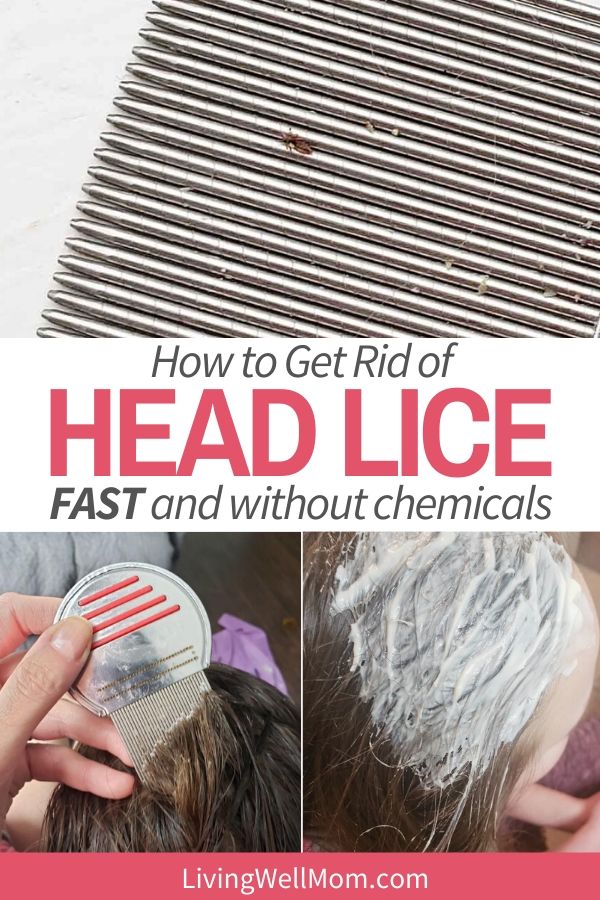 Doing a lice treatment at home may not be at the top of your bucket list, but this effective, simple solution will quickly take care of any infestation